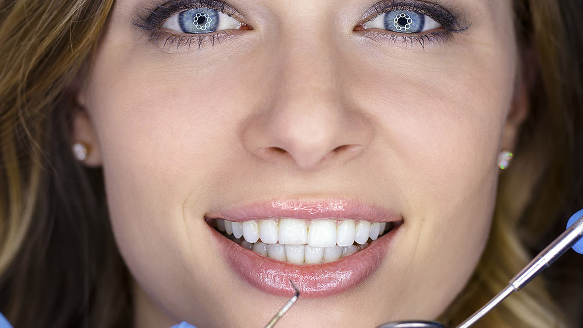 Cure dentali