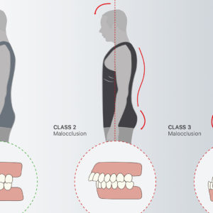 Denti e postura, il legame è stretto